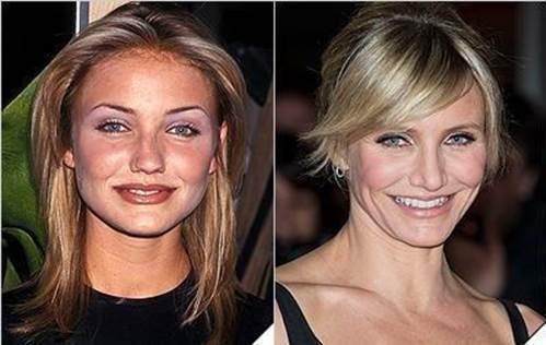 Cameron-Diaz-nose-job-before-and-after
