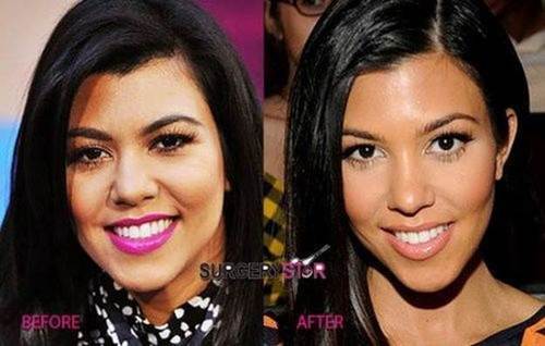 Kourtney-Kardashian-nose-job-before-and-after