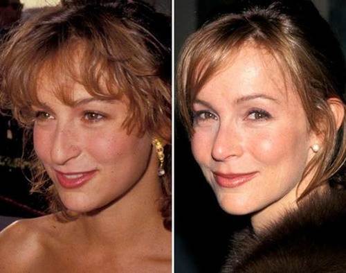 Jennifer-Grey-nose-job-before-and-after