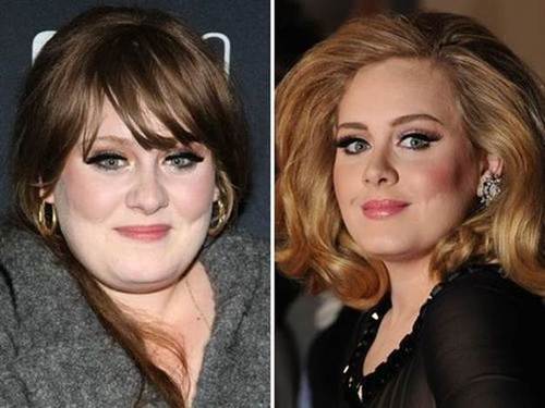Adele-nose-job-before-and-after