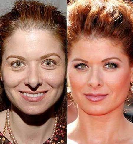 Debra-messing-nose-job-before-and-after