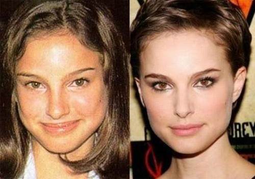 Natalie-portman-nose-job-before-and-after