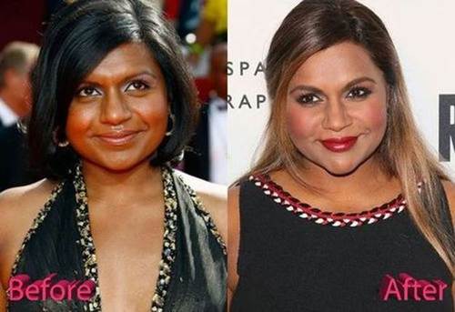 Mindy-Kaling-nose-job-before-and-after