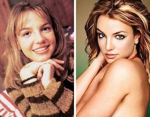 britney-spears-nose-job-before-and-after