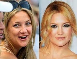 Kate-hudson-nose-job-before-and-after
