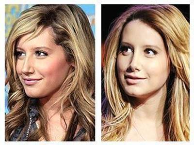 Ashley-Tisdale-nose-job-before-and-after