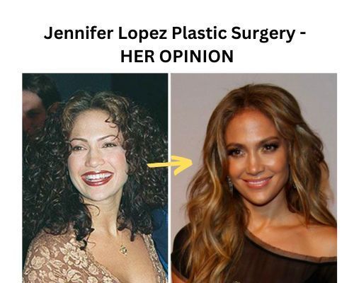 Jlo-plastic-surgery-her-opinion
