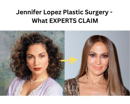 Jlo-plastic-surgery-experts-opinion