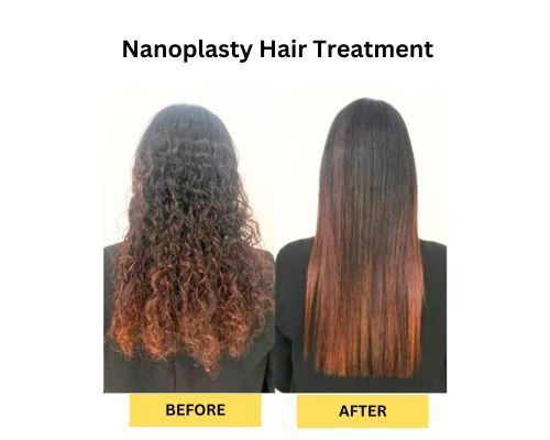 nanoplasty-before-and-after