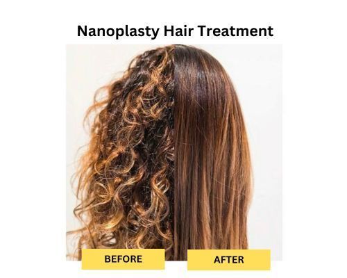 nanoplasty-before-after