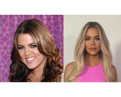 Khloe Kardashian Before & After Photos_ Shocking Transformation