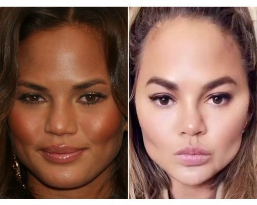 Chrissy Teigen, Before and After