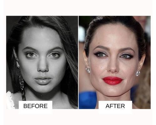 Anjelina_Jolie_lip_job