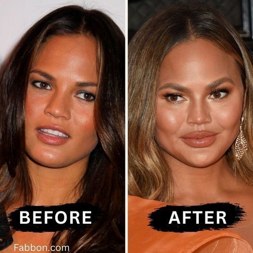 Before after minimal skincare Instagram post