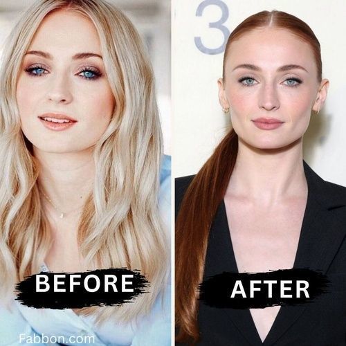 Before after minimal skincare Instagram post (10)