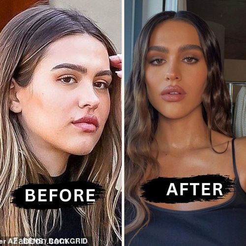 Before after minimal skincare Instagram post (12)