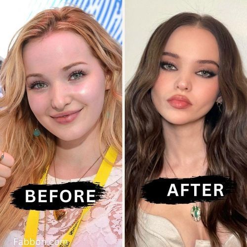 Before after minimal skincare Instagram post (13)