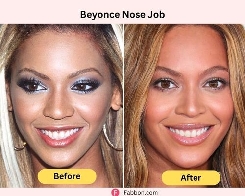 Beyonce Nose Job Before And After 2023 