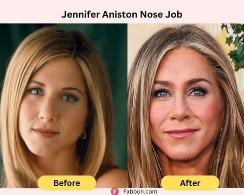 Jennifer-Aniston-nose-job