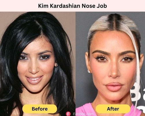 Kim-kardashian-nose-job