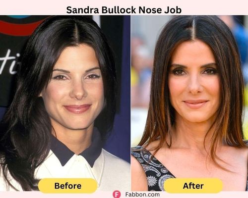 sandra-bullock-nose-job