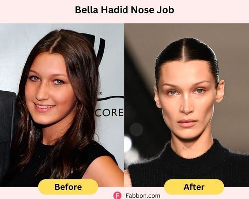 bella-hadid-nose-job