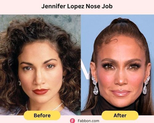 jennifer-lopez-nose-job-