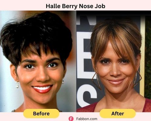halle-berry-nose-job