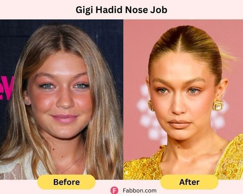 gigi-hadid-nose-job