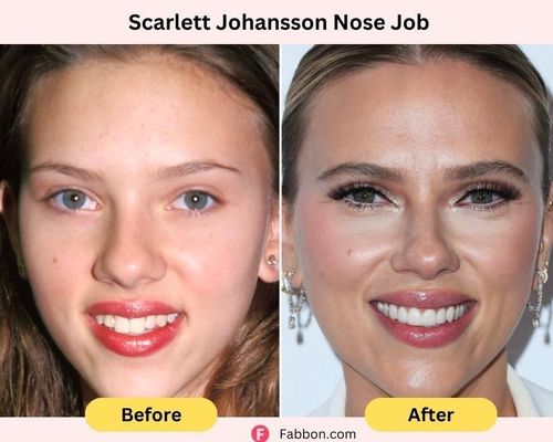 Scarlett Johansson-nose-job