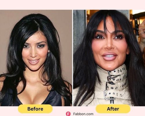 kim kardashian plastic surgery before and after