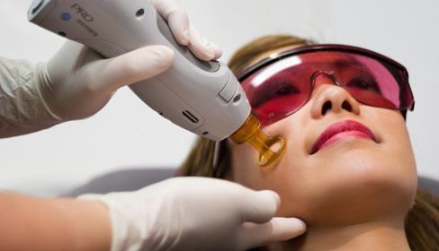 laser facial treatment3