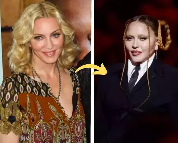 madonna-plastic-surgery-before-after