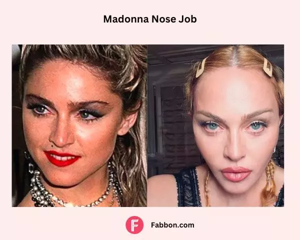 nose-job-madonna-plastic-surgery-before-after