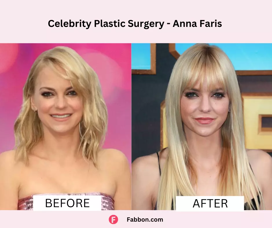 Anna-Faris-celeb-plastic-surgery