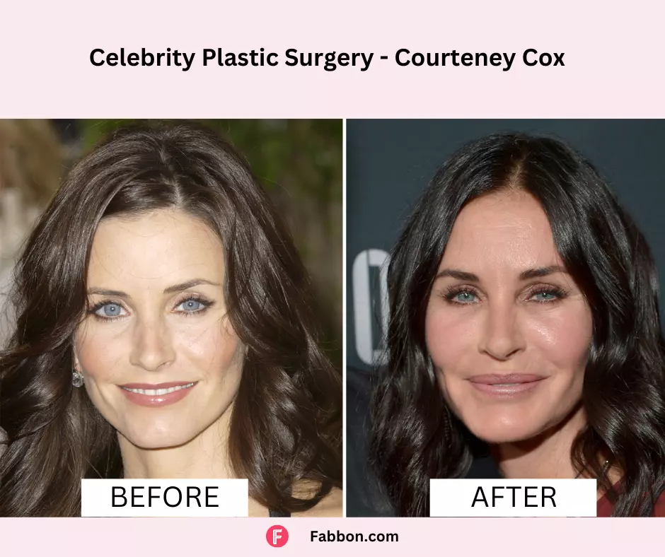Courtney-Cox-celebrity-plastic-surgery