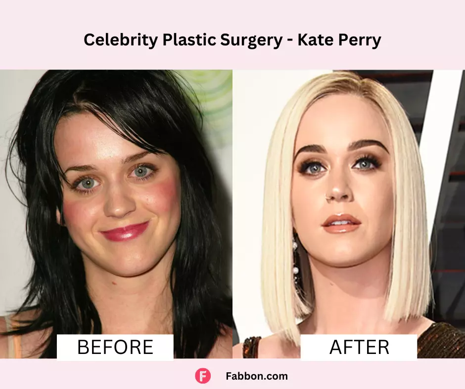 Katy-Perry-celebrity-plastic-surgery