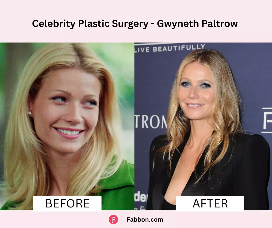 Gwyneth-Paltrow-celebrity-plastic-surgery