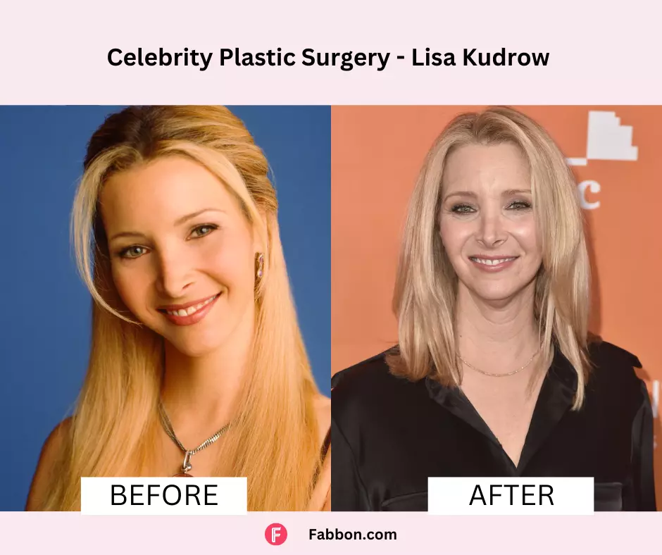 Lisa-kudrow-celeb-plastic-surgery