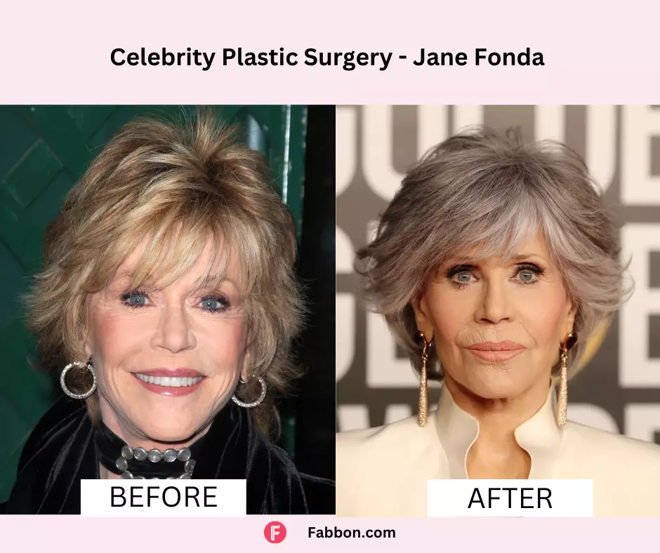 jane-fonda-celeb-plastic-surgery