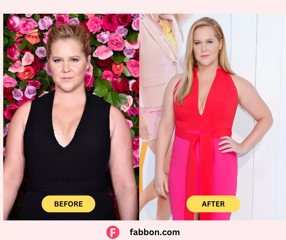Amy-Schumer-weight-loss