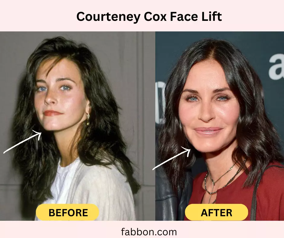 courteney-cox-face-lift