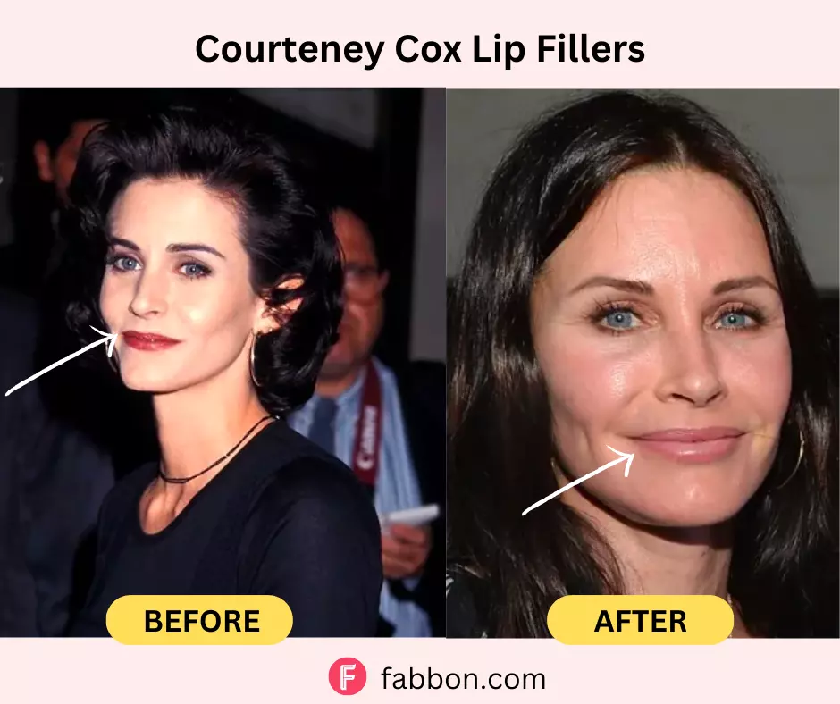 courtney-cox-lip-fillers