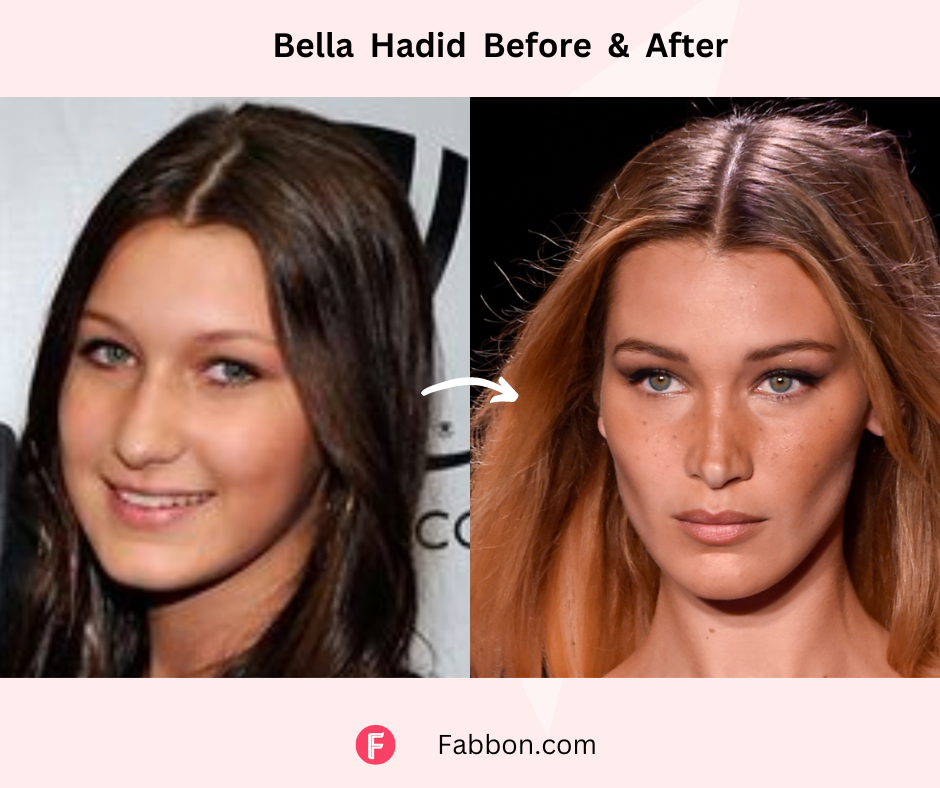 bella-hadid-before-after-weight-loss