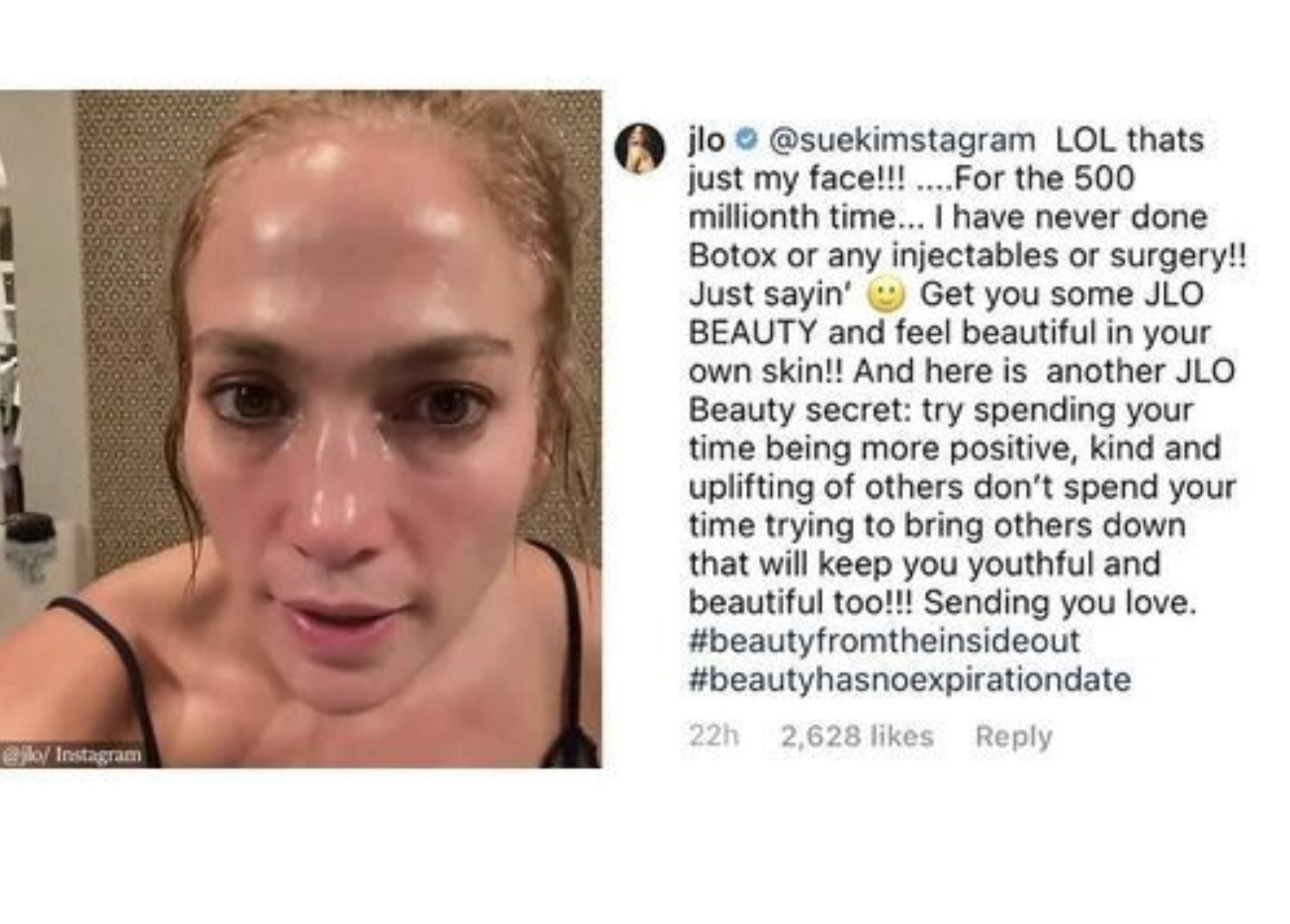 jlo-plastic-surgery-her-opinion