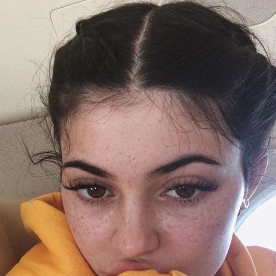 kylie-freckles
