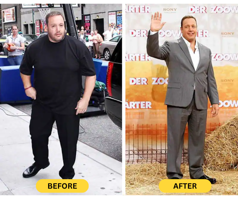 Kevin-James-weight-loss-before-and-after