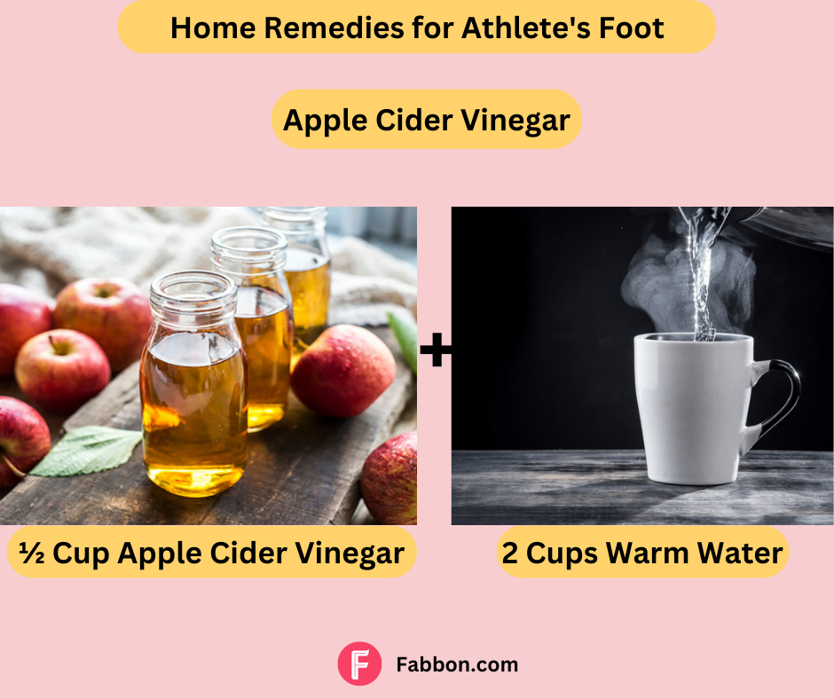 home remedies for athlete foot 1