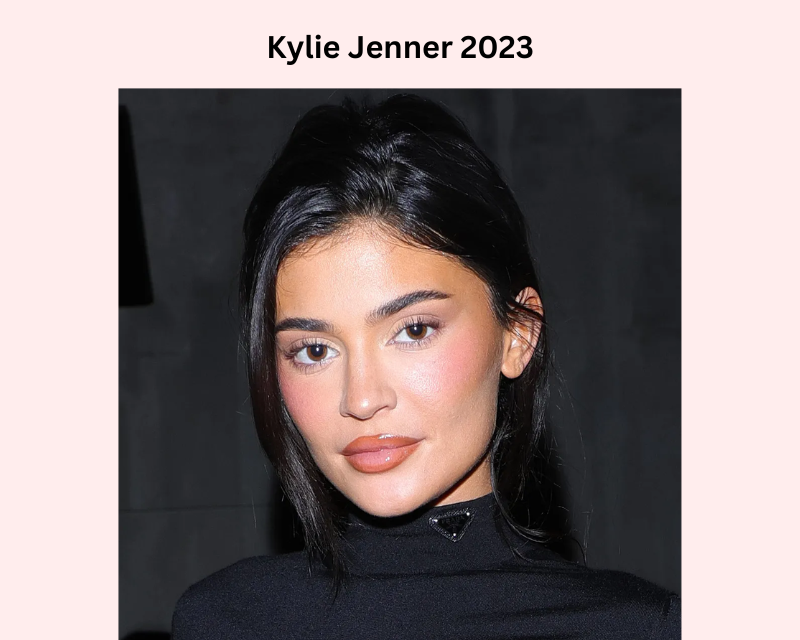 Kylie-jenner-nose-job (1)