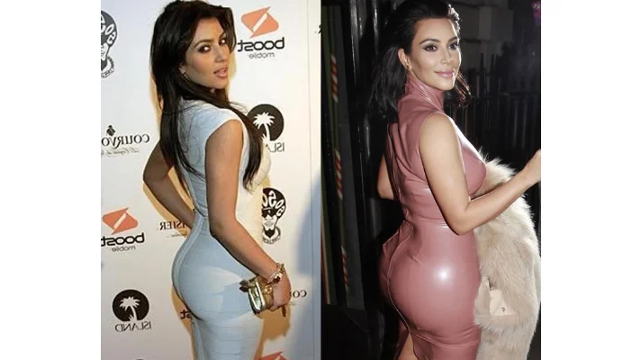 Kim-kardashian-butt-lift